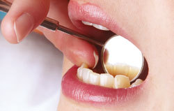 Entspannt beim Zahnarzt